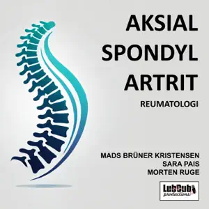 Aksial spondyl artrit